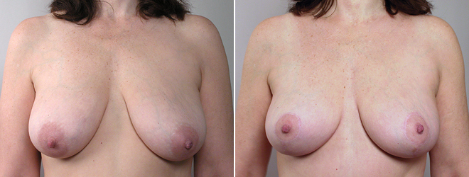 New Jersey Plastic Surgery Image