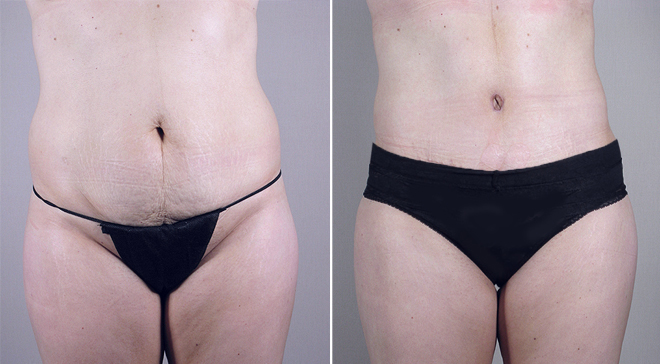 Image of Parker Center Patient