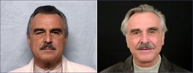 Image of Parker Center Patient