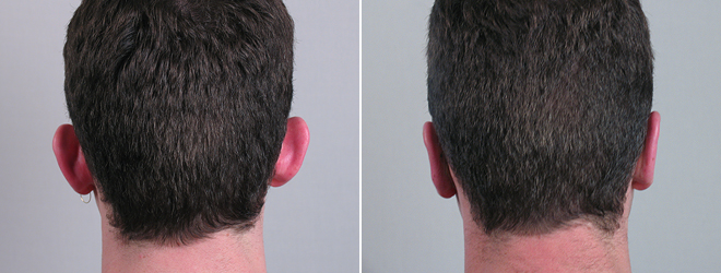 Image of Parker Center Patient