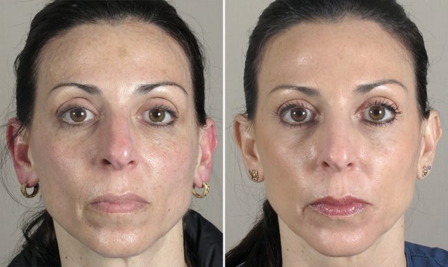 Image of Parker Center Patient