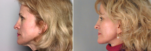 New Jersey Plastic Surgery