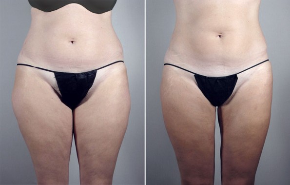 Image of Parker Center Patient