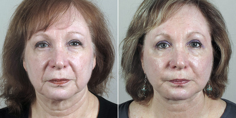 Image of Parker Center Patient