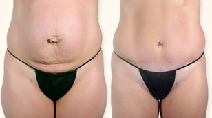 Before and After Gallery