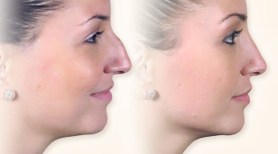 Before and After Gallery