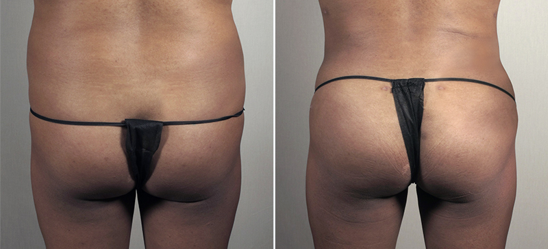 Image of Parker Center Patient