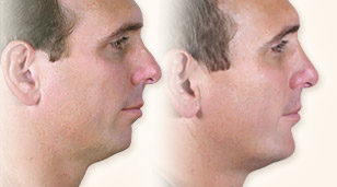 Before and After Gallery