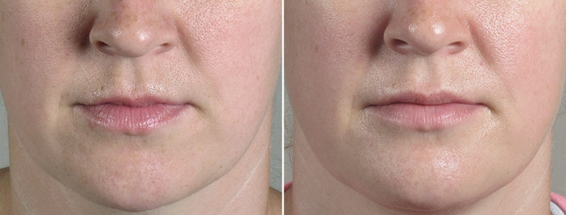 Image of Parker Center Patient