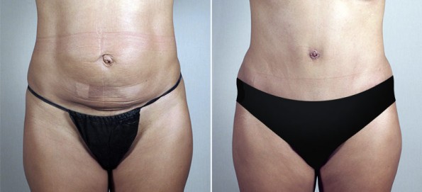 Image of Parker Center Patient