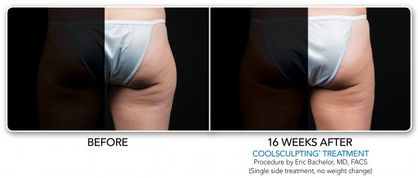 CoolSmooth New Jersey Image