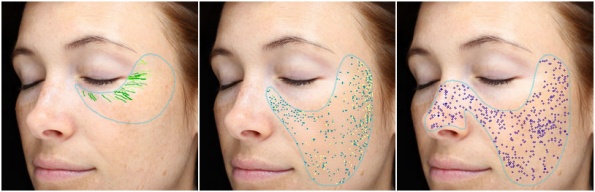 VISIA New Jersey Image VISIA New Jersey Image