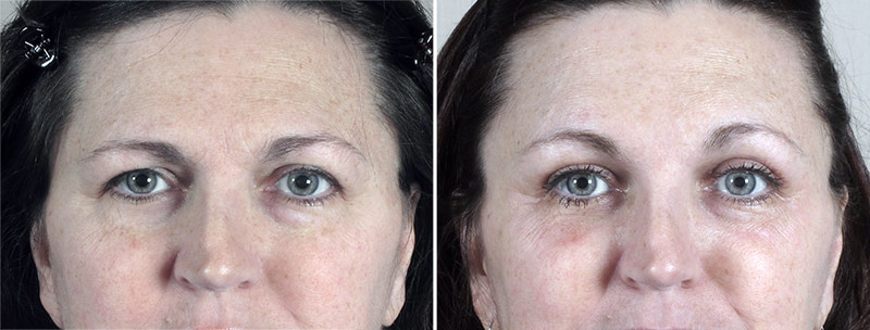 Image of Parker Center Patient