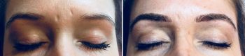 Eyebrow Microblading Patient 1