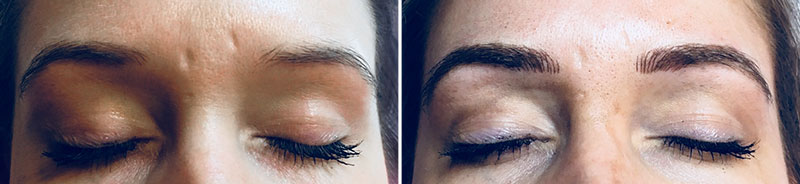 Eyebrow Microblading Patient 1