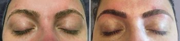 Eyebrow Microblading Patient 2
