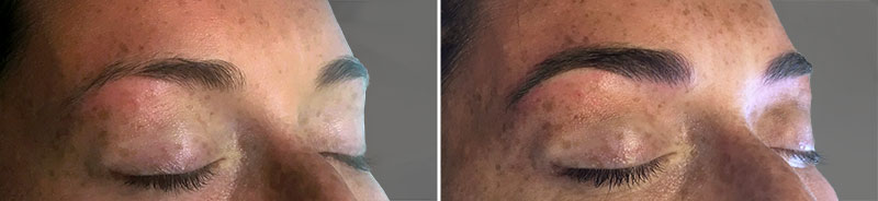 Permanent Makeup Patient 3