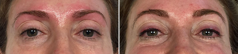 Permanent Makeup Patient 6