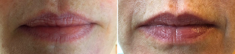 Permanent Makeup Patient 2