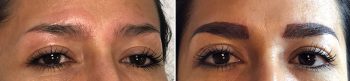 Permanent Makeup Patient 7