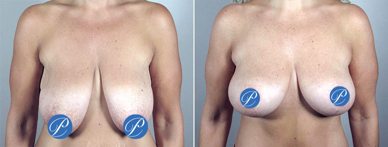 Image of Parker Center Patient