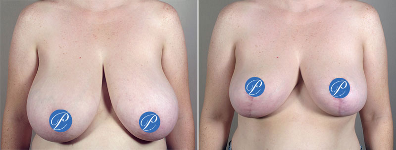 Image of Parker Center Patient