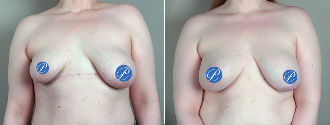 Image of Parker Center Patient